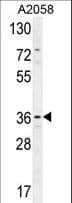 GRINA Antibody (aa117-146)