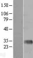 Human MBL2 / Mannose Binding Protein (Over-Expression Lysate Myc-DDK (Flag))