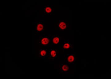 XPO4 / Exportin 4 Antibody