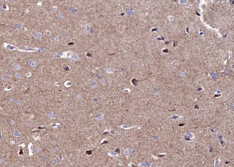 CAMK2A / CaMKII Alpha Antibody