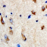 Polyclonal Rabbit anti-Human SHMT / SHMT1 Antibody (IHC, WB)