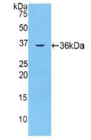 F5 / Factor Va Antibody (aa1863-2161)