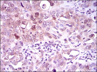 ACLY / ATP Citrate Lyase Antibody (Amino Acid: 306-502, clone 5F8D11)