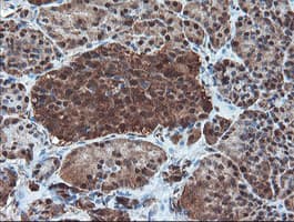 PSMA6 Antibody (clone OTI7C2)