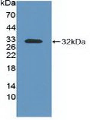 ITGAV/Integrin Alpha V/CD51 Antibody (aa71-322)