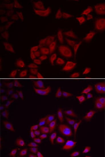 PIKFYVE / PIP5K Antibody