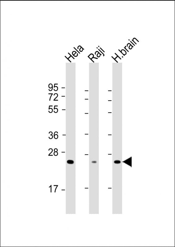 Monoclonal Mouse anti-Human RAB14 Antibody (clone 1779CT692.32.86, WB)