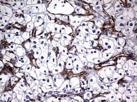 RASGRP3 / GRP3 Antibody (aa380-690, clone OTI2C11)