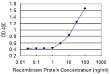 Monoclonal Mouse anti-Human ASMT / HIOMT Antibody (clone 1F8)