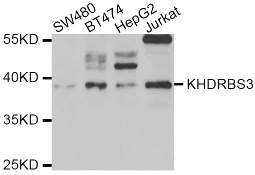Polyclonal Rabbit anti-Human KHDRBS3 / SLM2 Antibody (IHC, WB)