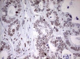 CD5 Antibody (clone OTI10F4)
