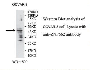 ZNF662 Antibody (aa9-299)
