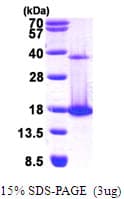 Human CLP / COTL1 Protein (Recombinant His)