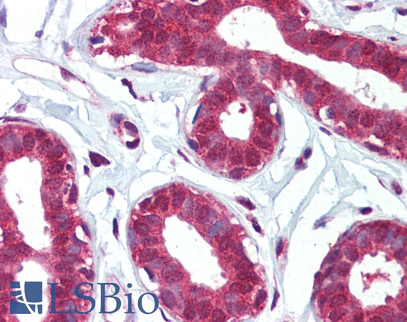 IHC-plus™ ITGA6/Integrin Alpha 6/CD49f Antibody (aa1043-1072)
