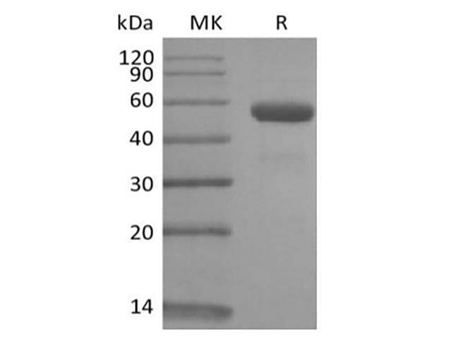 Rhesus monkey CD79B / CD79 Beta Protein (Recombinant Fc, C-terminus)