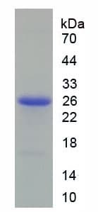 Rat PRDX6 / Peroxiredoxin 6 Protein (Recombinant His)