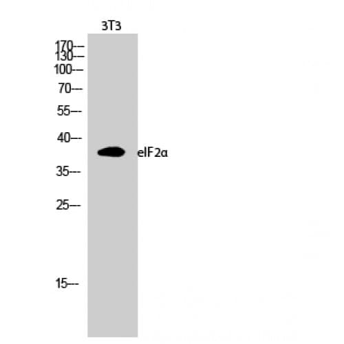 Polyclonal Rabbit anti-Human EIF2S1 Antibody (30-110 aa, IHC, WB)