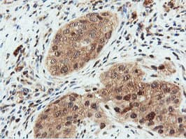 DUSP23 Antibody (clone OTI3C10)