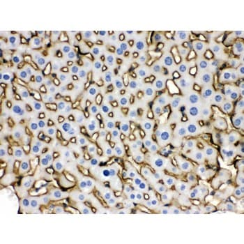 Polyclonal Rabbit anti-Mouse SLC10A1 / NTCP Antibody (aa296-336, IHC, WB)