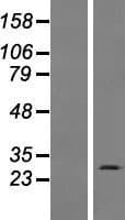 C15orf59 Protein (Over-Expression Lysate Myc-DDK (Flag))