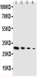 Polyclonal Rabbit anti-Human GDNF Antibody (aa142-158, IHC, WB)