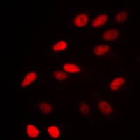 N-CoR / NCOR1 Antibody (N-Terminus)