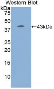 Complement C8b Antibody (aa162-504, HRP)