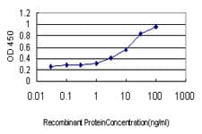 FZD5 / Frizzled 5 Antibody (clone 6A3)