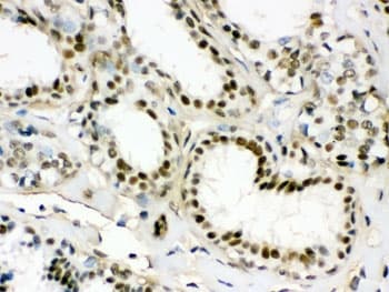 EWSR1 / EWS Antibody