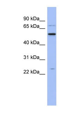 ZCRB1 Antibody (N-Terminus)