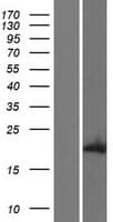 DUX1 Protein (Over-Expression Lysate Myc-DDK (Flag))