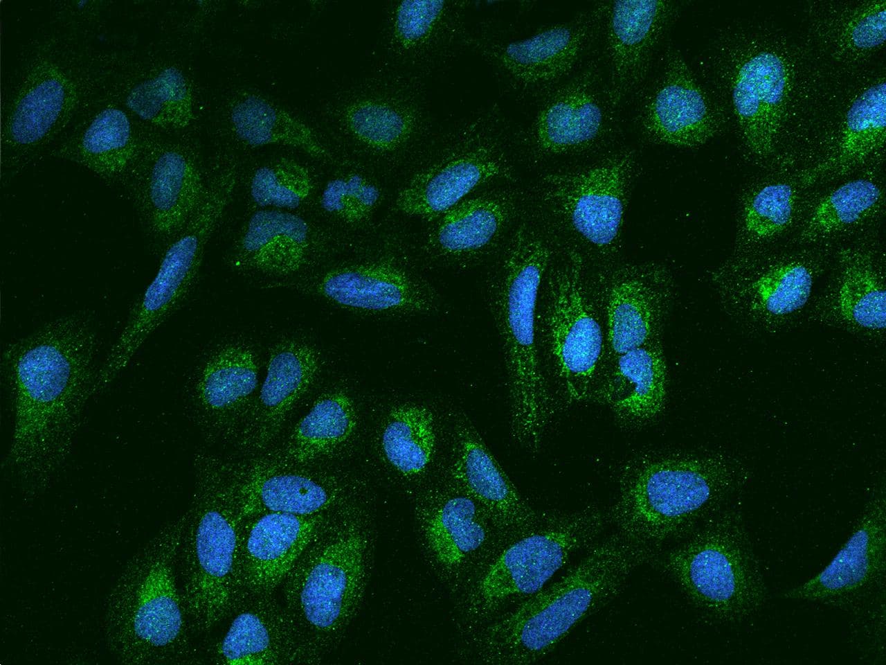 Polyclonal Rabbit anti-Human ANGPTL2 / ARP2 Antibody (IF)