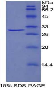 Rat TRADD Protein (Recombinant His-T7)