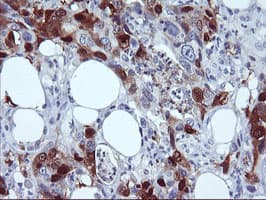 Monoclonal Mouse anti-Human SERPINB2 / PAI-2 Antibody (clone OTI3H1, IHC, WB)