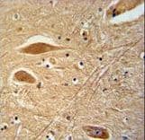 FGB / Fibrinogen Beta Chain Antibody (aa29-58)