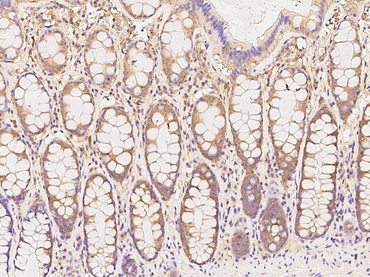 GAK Antibody