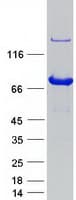 Human EXOC7 Protein (Recombinant Myc-DDK (Flag))