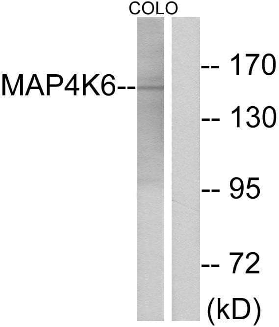 MAP2K6 / MEK6 / MKK6 Antibody