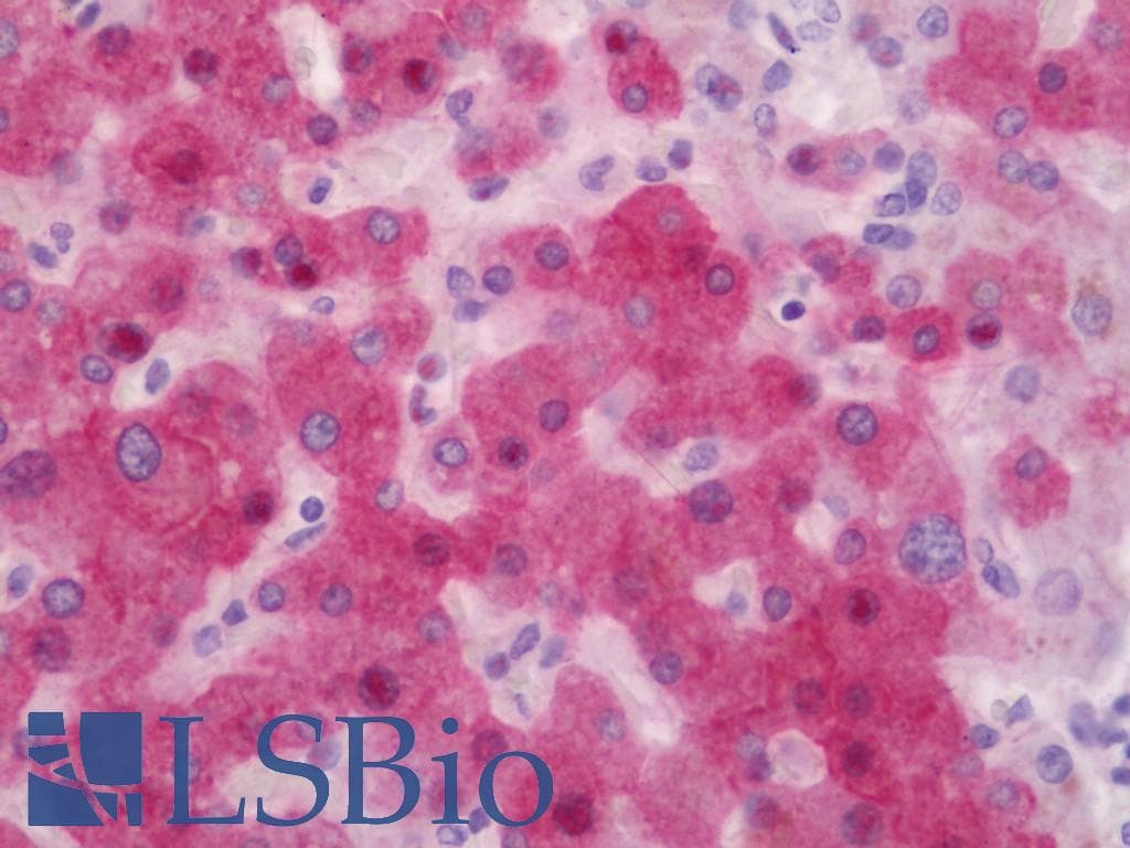 IHC-plus™ CYP2E1 Antibody (aa371-420)