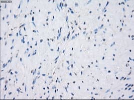 Monoclonal Mouse anti-Human GBP2 Antibody (clone OTI1E5, IHC, IF, WB)