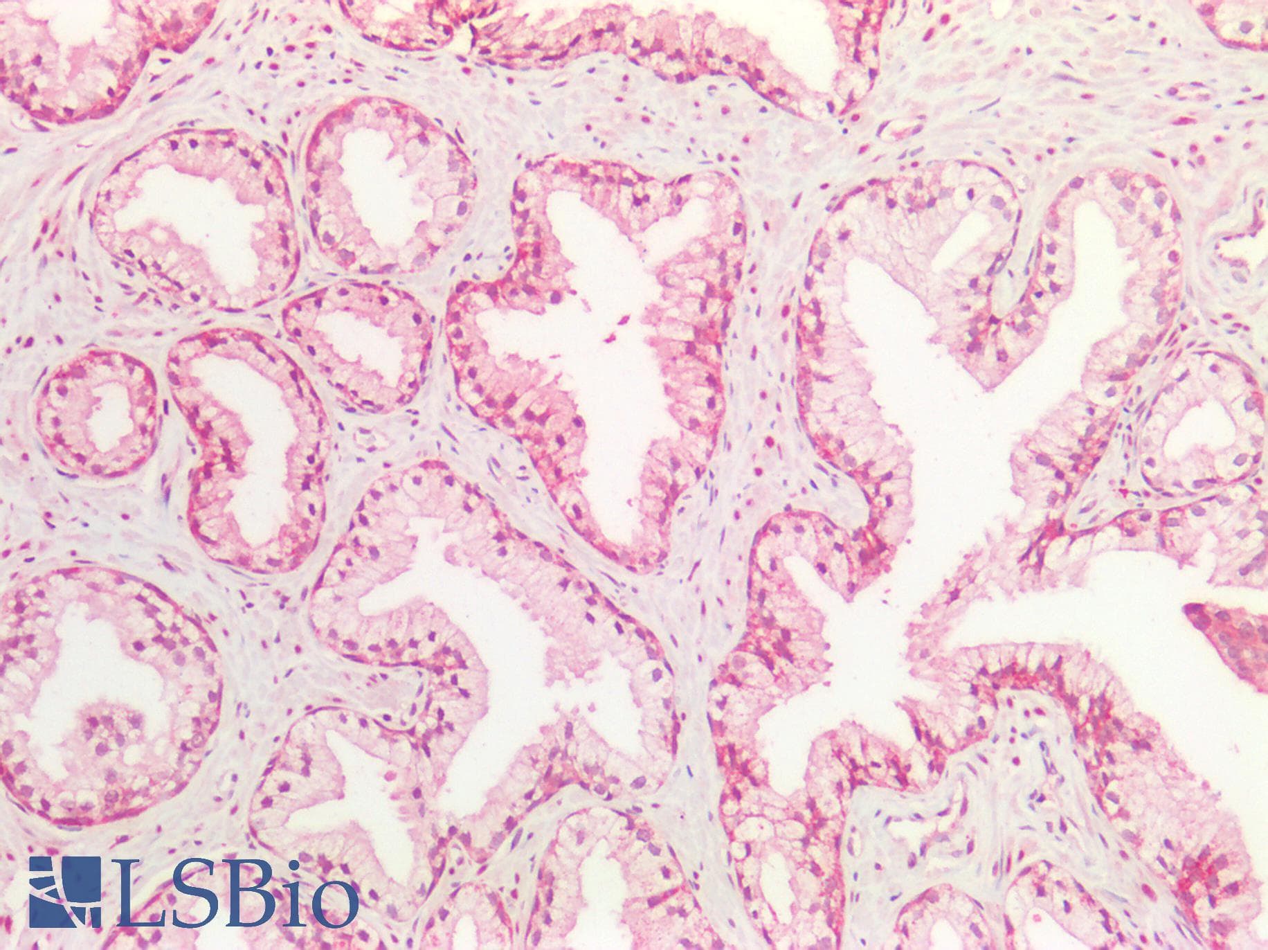 PathPlus™ Polyclonal Rabbit anti-Human IGF2 Antibody (IHC, WB)