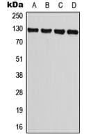 TRPM8 Antibody (Internal)