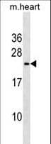 Polyclonal Rabbit anti-Mouse TREM2 / TREM-2 Antibody (aa22-48, WB)