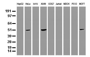 Monoclonal Mouse anti-Human SQSTM1 Antibody (clone UMAB13, IHC, IF, WB)