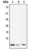 HMGN1 / HMG14 Antibody (Internal)