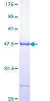 Human TRIP / LRRFIP1 Protein (Recombinant GST, N-terminus)