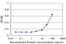 Monoclonal Mouse anti-Human RPS20 / Ribosomal Protein S20 Antibody (clone 1G12)