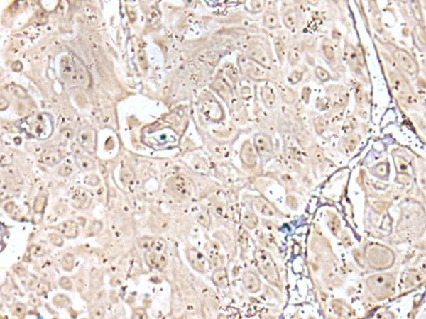 VRK3 Antibody