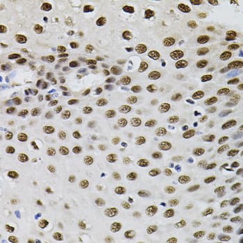 GTF2I / TFII I Antibody