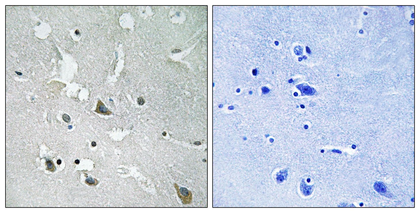 TIRAP Antibody (phospho-Tyr86)